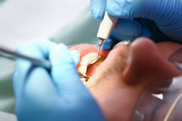 Best After-Hours Emergency Dentist in Brass Castle, NJ